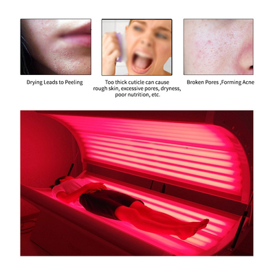 Camas claras vermelhas da terapia do diodo emissor de luz dos cuidados com a pele 3.kw para o tratamento da acne